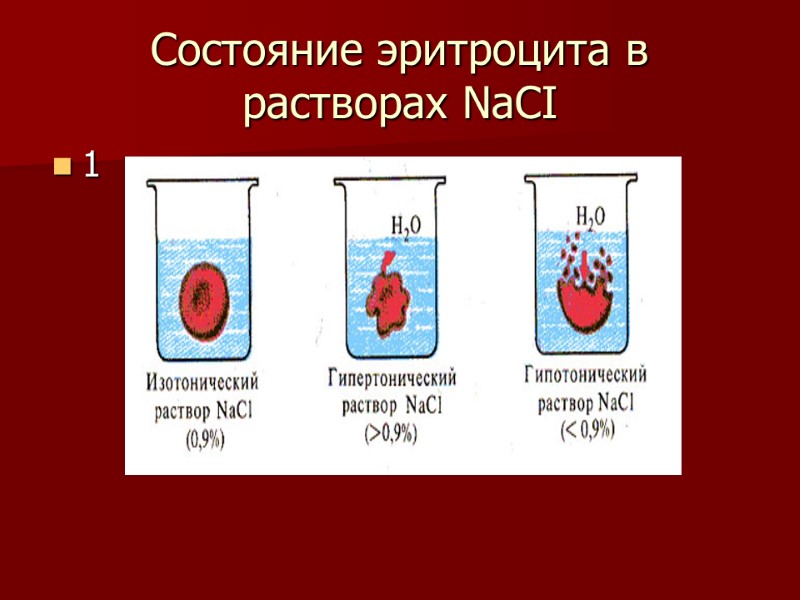 Состояние эритроцита в растворах NаСI 1